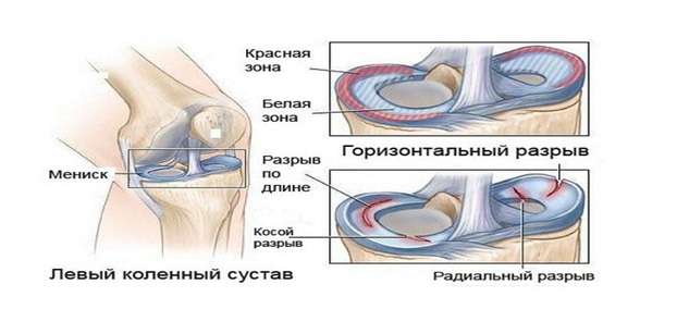 Статьи